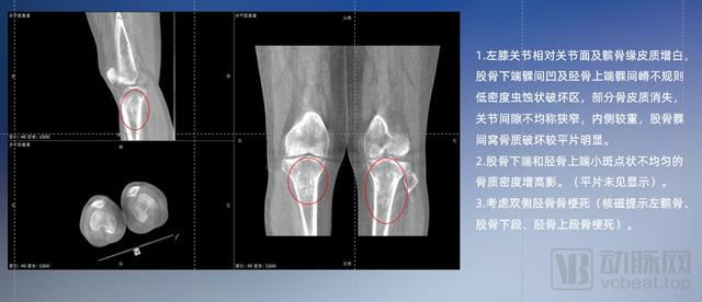 杏彩体育DR影像什么是DR影像？DR影像